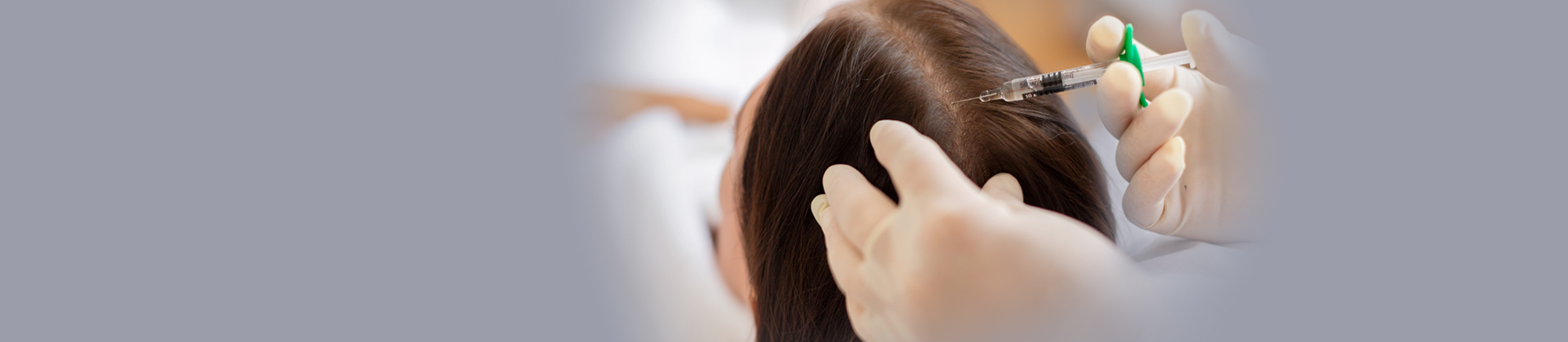 Dermatologist administering PRP and mesotherapy for hair regrowth