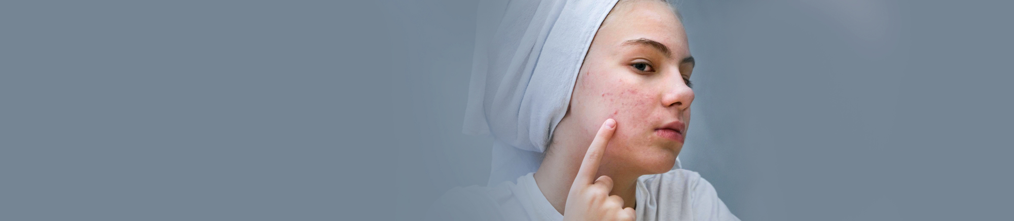 Laser scar removal treatment for smooth and clear skin