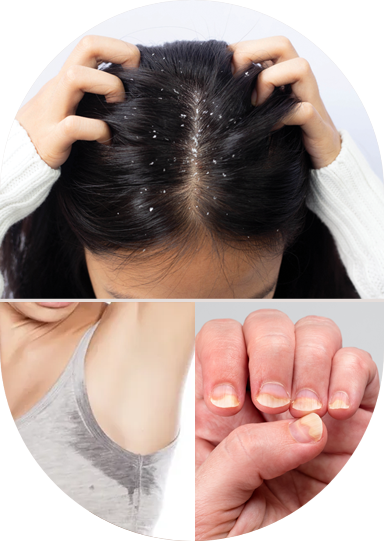 Advanced dermatology treatment for dandruff and scalp irritation