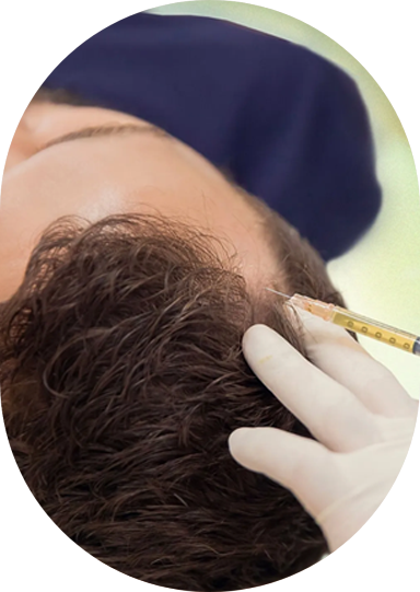 Best clinic for treating hair thinning and baldness in Kochi