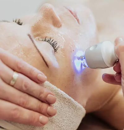 Dermatologist performing laser treatment for melasma and pigmentation