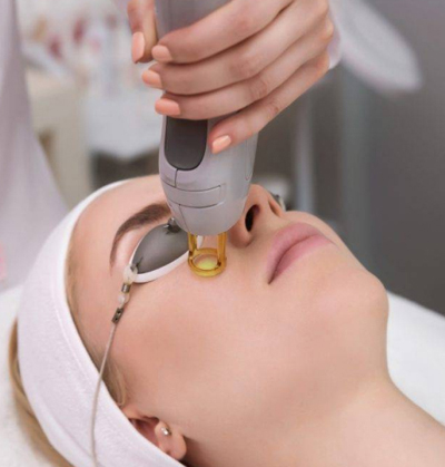 Advanced laser procedure for reducing periorbital darkness